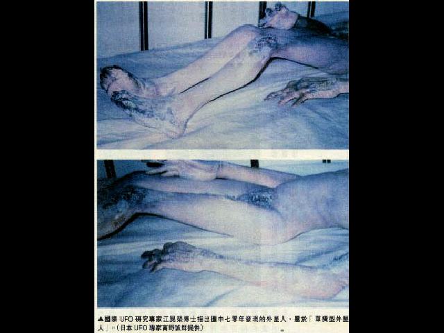 Immagine autopsia alieno 2